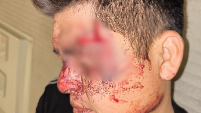 Imagen del hombre herido tras el robo / AH Imagen del hombre herido tras el robo / AH